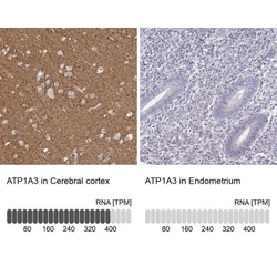 Sodium Potassium ATPase Alpha 3 Antibody, Novus Biologicals:Antibodies:Primary